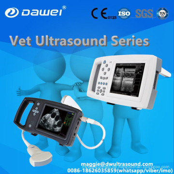 DW-600 Taschen-Digital-Ultraschallgerät für die Gynäkologie